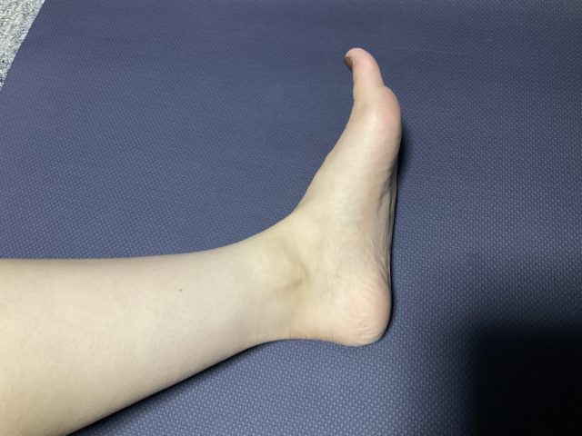子供の足の痛み、有痛性外脛骨とは　新潟市西区整骨院
