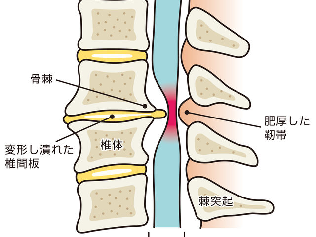 原因と危険因子